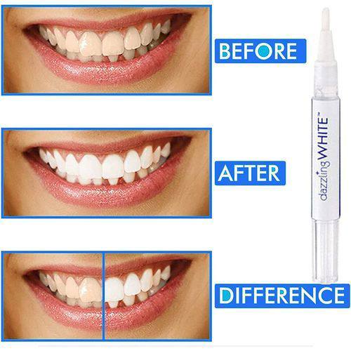 باقة الابتسامة الهوليودية | Pack Hollywood Smile